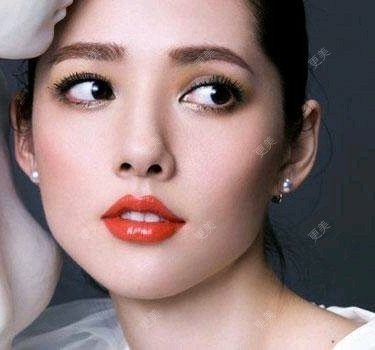 鼻形态修复