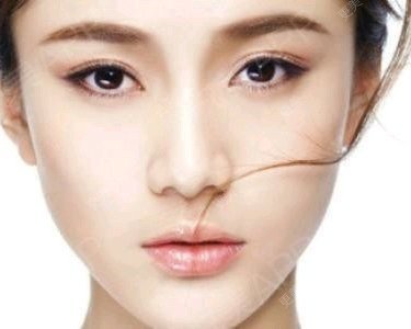 鼻形态修复