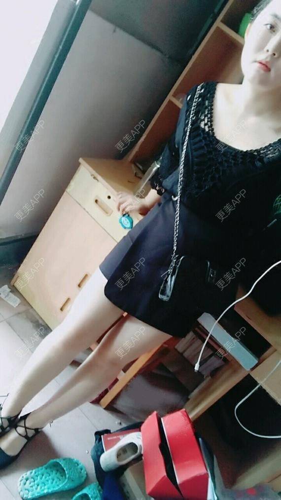 更美用户qr7x2jakom的吸脂瘦大腿日记