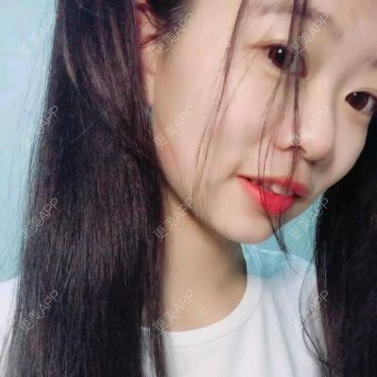 更美 - 许巧圆 医生的假体隆胸经验 | 假体隆胸 | 合肥