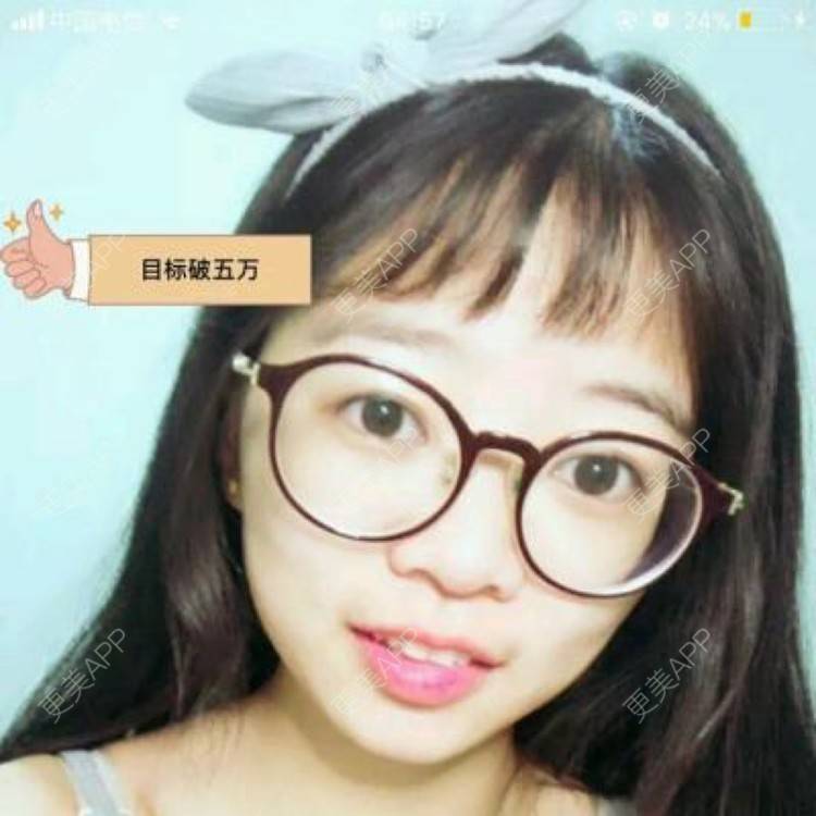 更美 - 许巧圆 医生的假体隆胸经验 | 假体隆胸 | 合肥