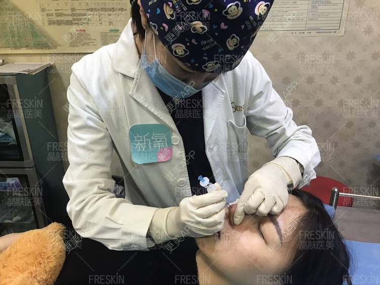 更美 - 更美用户r1mCniLjEb的埋线隆鼻经验 | 怀化 | 埋线隆鼻