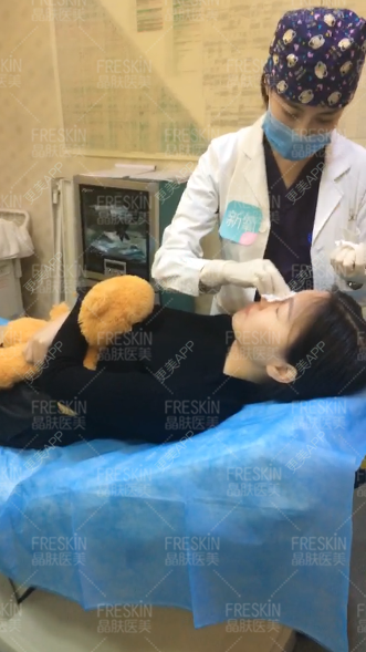 更美 - 更美用户r1mCniLjEb的埋线隆鼻经验 | 怀化 | 埋线隆鼻