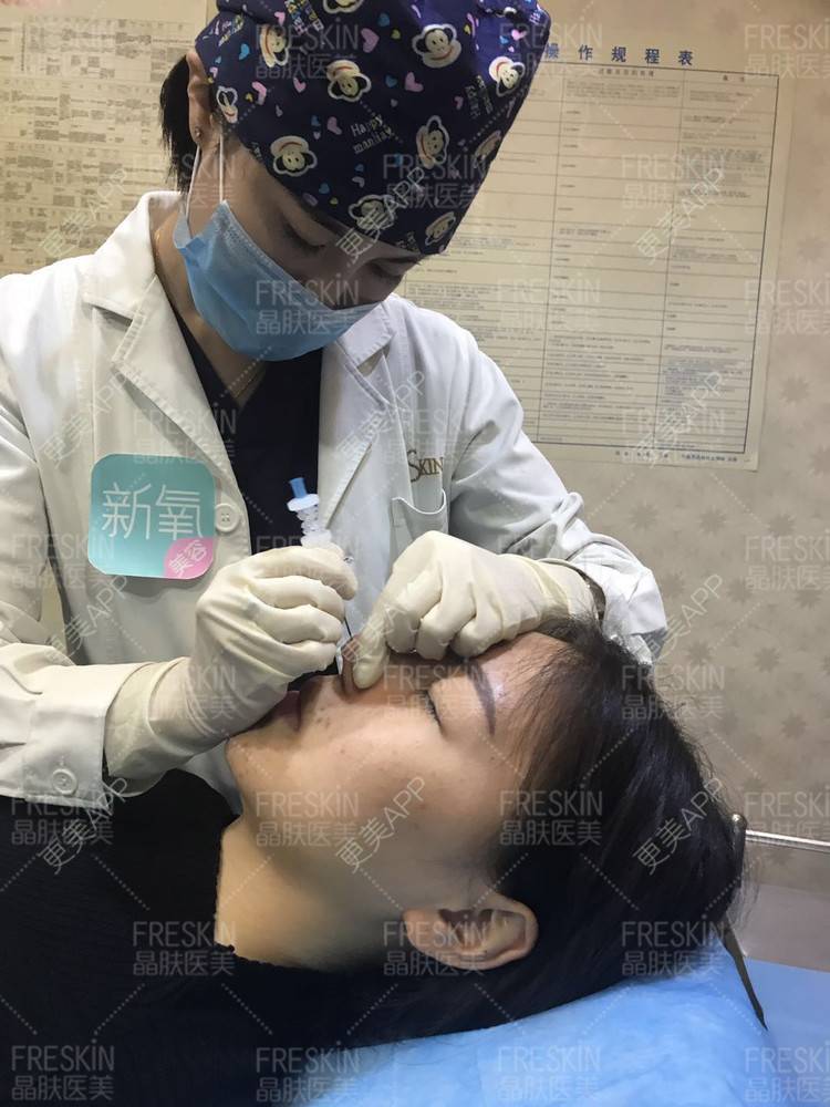 更美 - 更美用户r1mCniLjEb的埋线隆鼻经验 | 怀化 | 埋线隆鼻