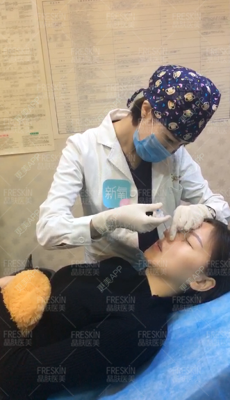 更美 - 更美用户r1mCniLjEb的埋线隆鼻经验 | 怀化 | 埋线隆鼻