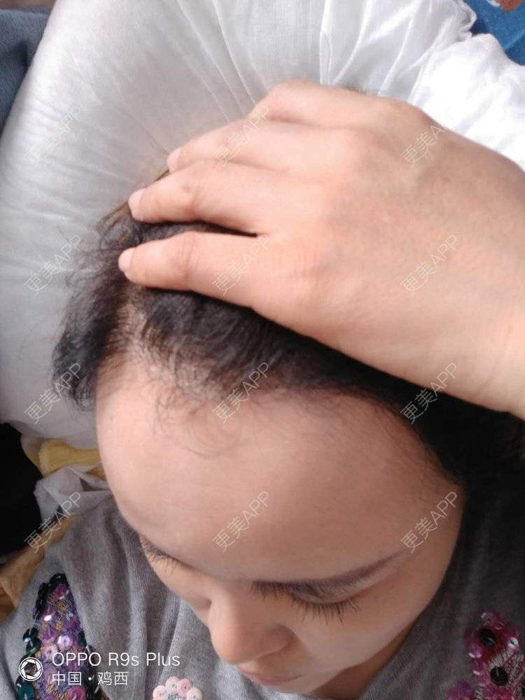 更美 - 刘爽 医生的经验 | 哈尔滨