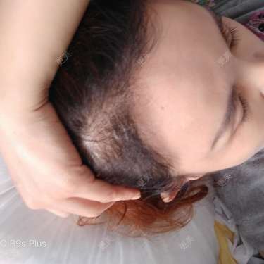 刘爽 医生
