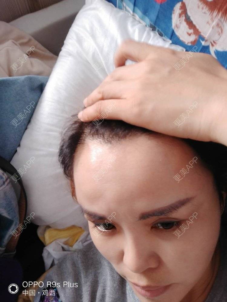 更美 - 刘爽 医生的经验 | 哈尔滨