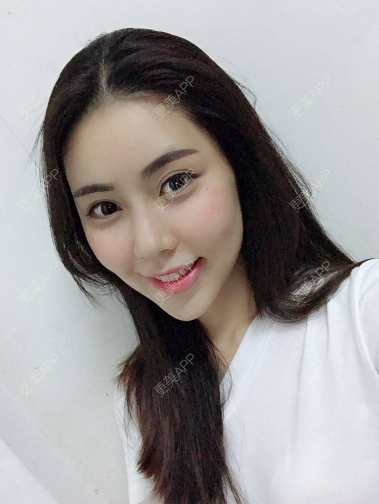 更美 - 更美用户1X3Nj1mzEe的经验 | 广州