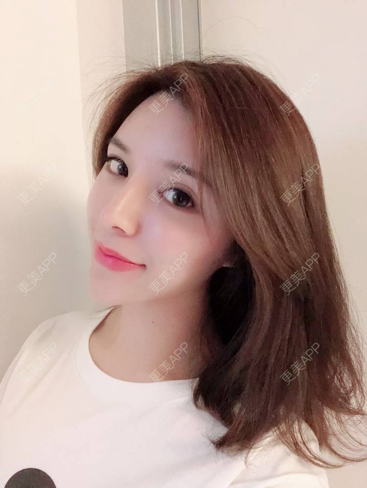 更美 - 罗莉 医生的鼻部多项经验 | 福州 | 鼻部多项