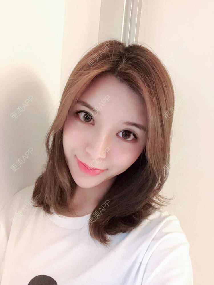 更美 - 罗莉 医生的鼻部多项经验 | 福州 | 鼻部多项