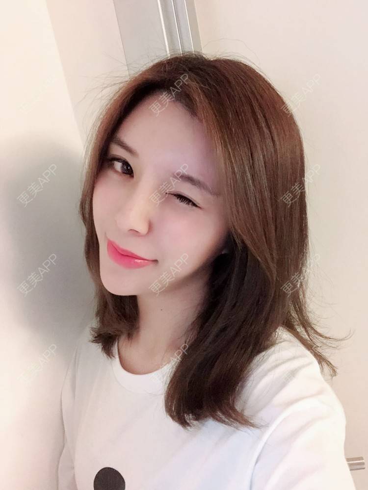 更美 - 罗莉 医生的鼻部多项经验 | 福州 | 鼻部多项