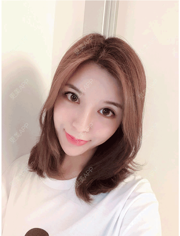 更美 - 罗莉 医生的鼻部多项经验 | 福州 | 鼻部多项
