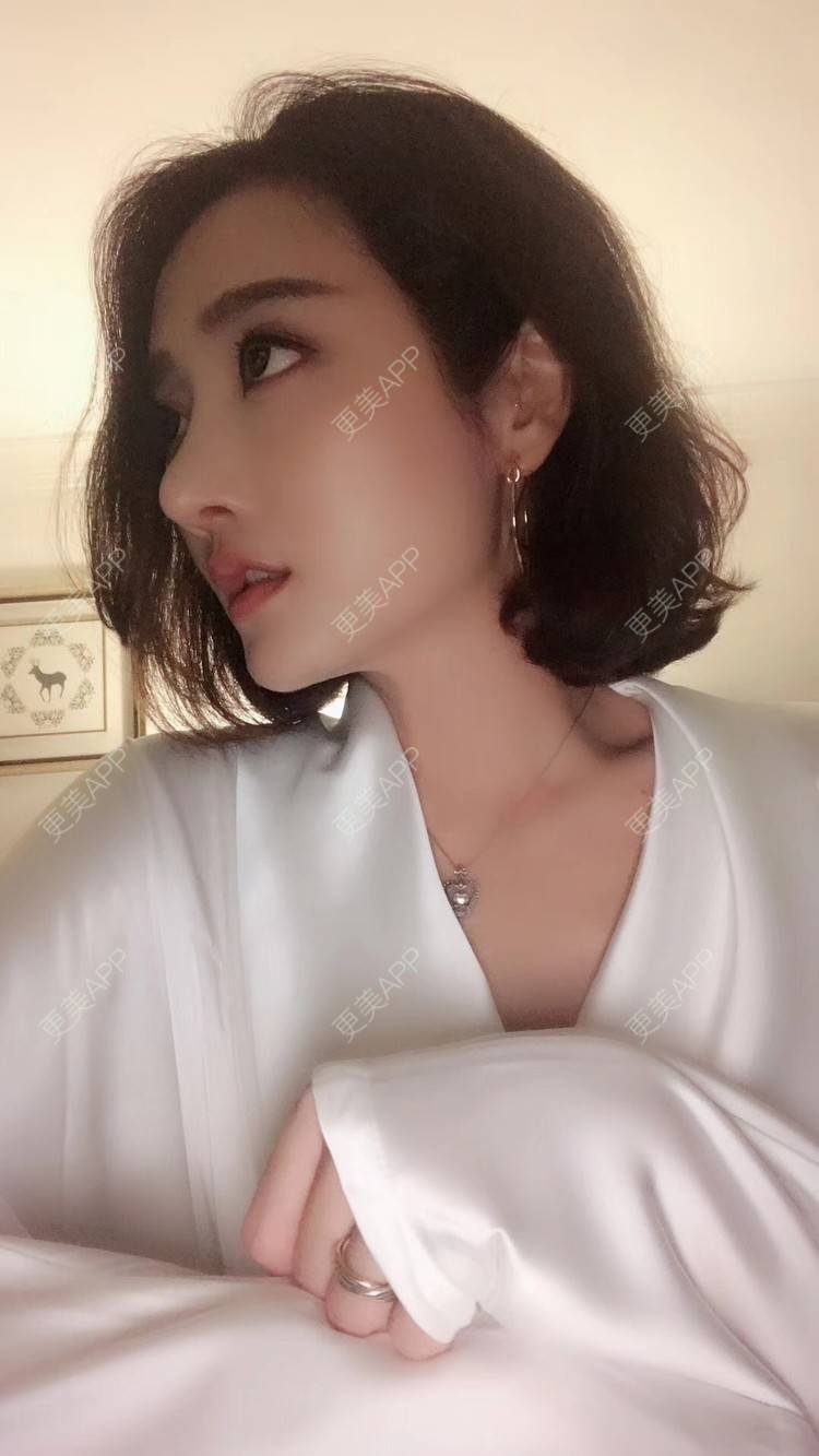 更美 - 莹莹D緈諨的鼻部多项经验 | 膨体隆鼻 | 视频日记 | 隆鼻 | 鼻部多项 | 广州 | 驼峰鼻矫正 | 鼻形态修复