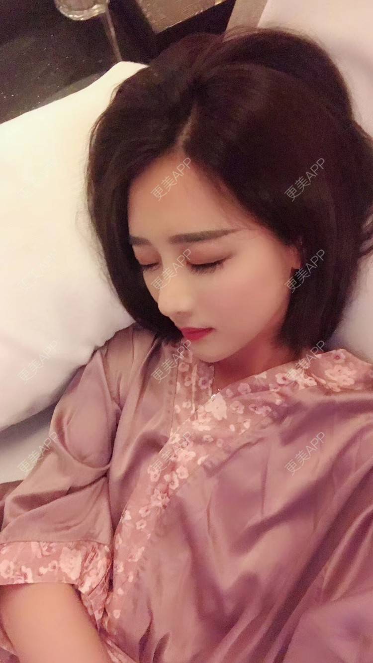 更美 - 莹莹D緈諨的鼻部多项经验 | 膨体隆鼻 | 视频日记 | 隆鼻 | 鼻部多项 | 广州 | 驼峰鼻矫正 | 鼻形态修复