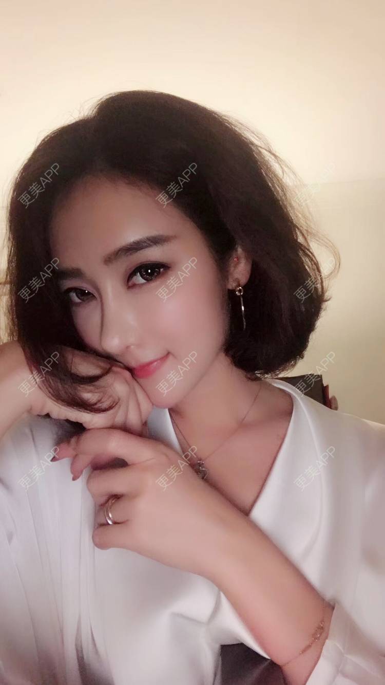 更美 - 莹莹D緈諨的鼻部多项经验 | 膨体隆鼻 | 视频日记 | 隆鼻 | 鼻部多项 | 广州 | 驼峰鼻矫正 | 鼻形态修复