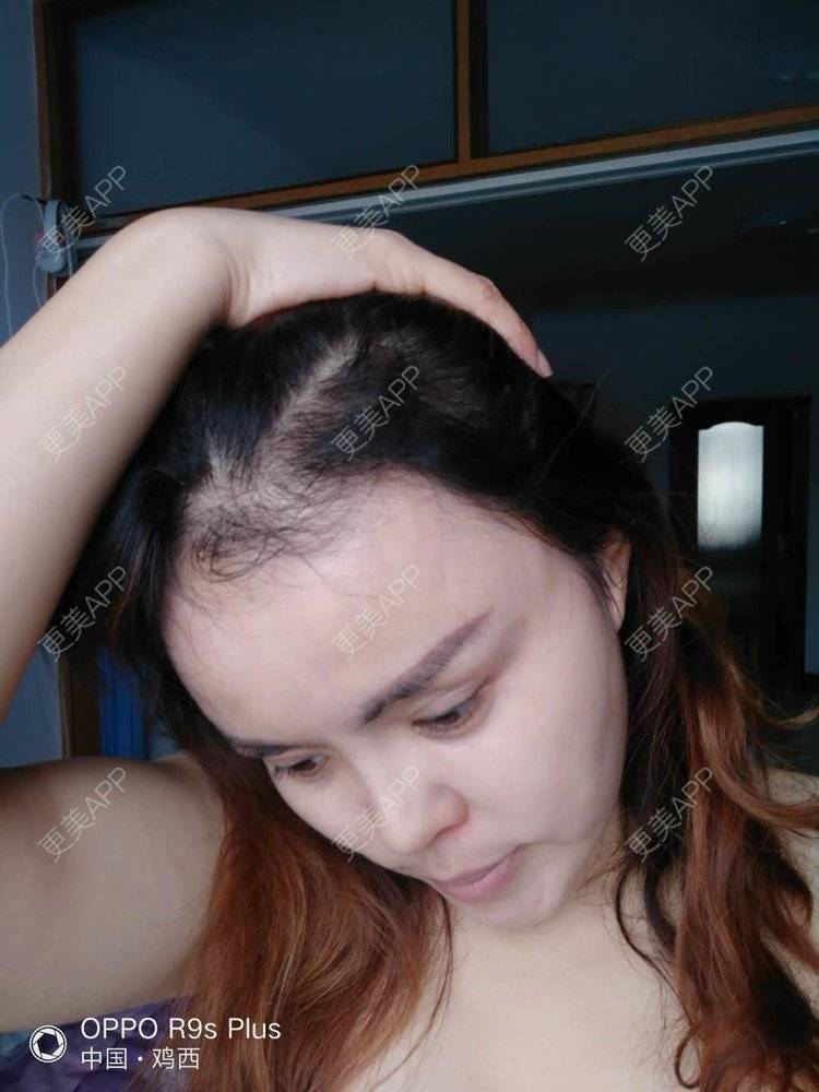 更美 - 刘爽 医生的经验 | 哈尔滨