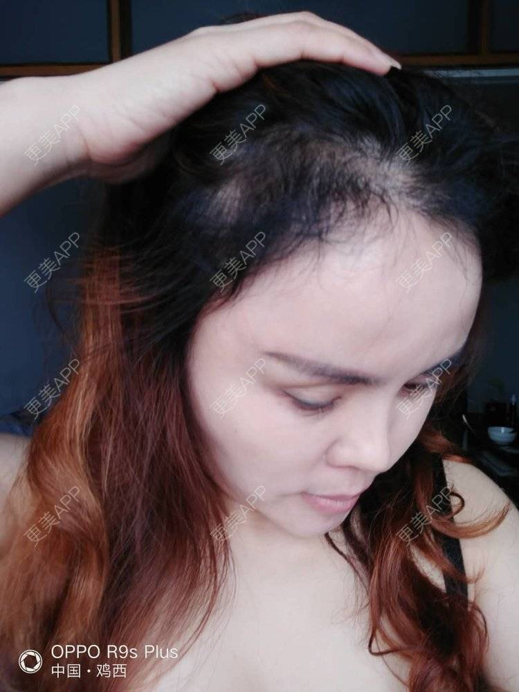 更美 - 刘爽 医生的经验 | 哈尔滨