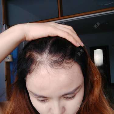 刘爽 医生