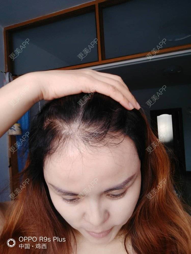 更美 - 刘爽 医生的经验 | 哈尔滨