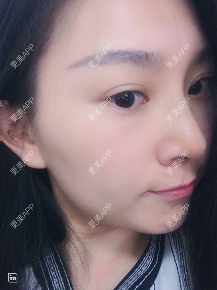 忆倾城狮的鼻综合日记