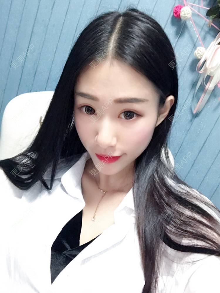 更美 - xlb💕的果酸焕肤经验 | 果酸焕肤 | 南宁