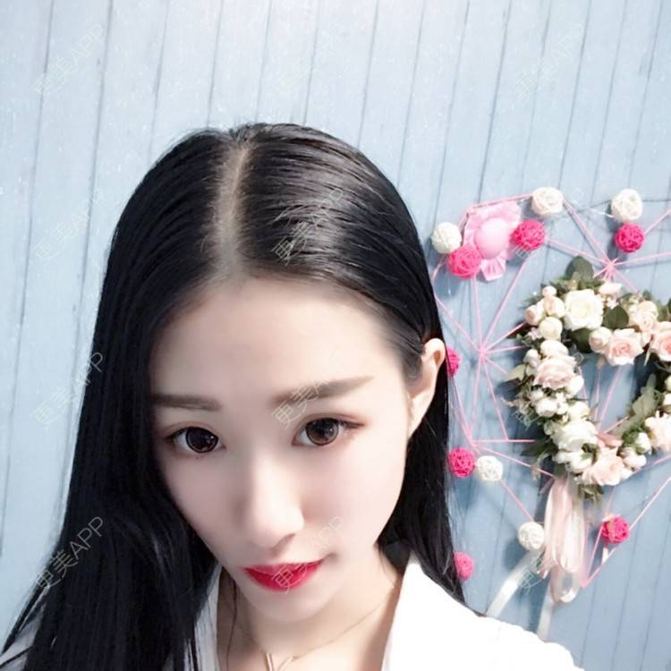 更美 - xlb💕的果酸焕肤经验 | 果酸焕肤 | 南宁