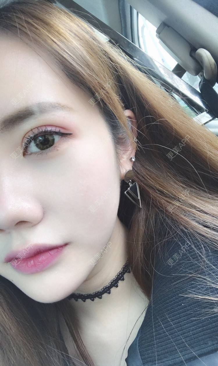 盛夏天空的双眼皮日记