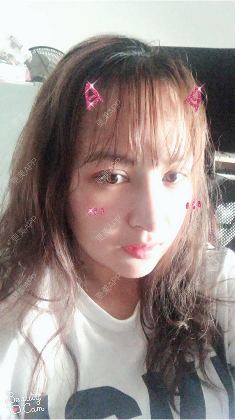 更美 - 淡淡蛋蛋的下巴经验 | 下巴 | 南宁