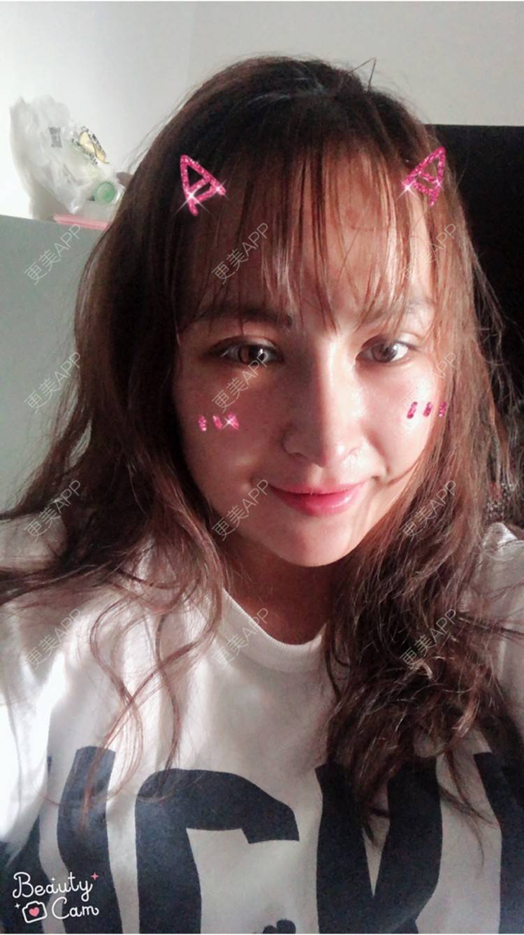 更美 - 淡淡蛋蛋的下巴经验 | 下巴 | 南宁