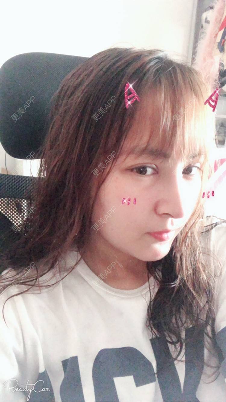 更美 - 淡淡蛋蛋的下巴经验 | 下巴 | 南宁