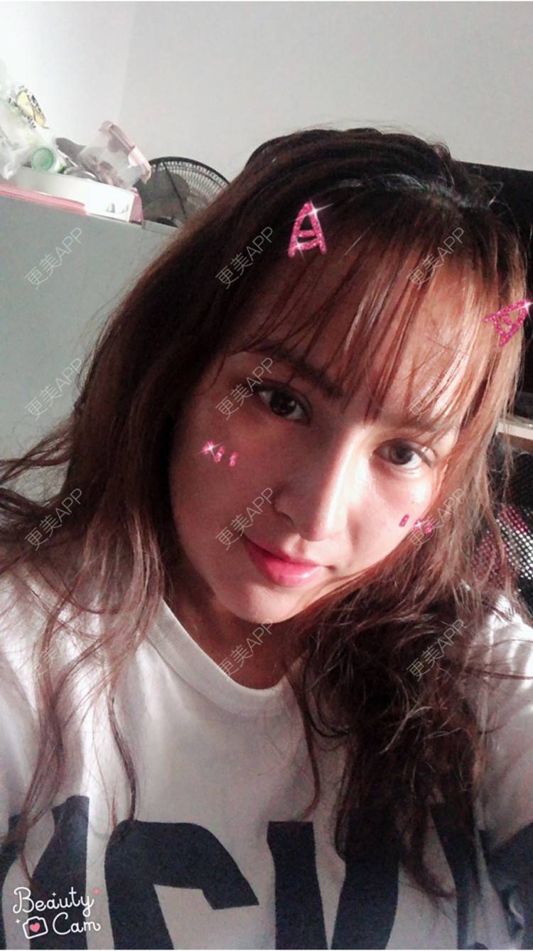 更美 - 淡淡蛋蛋的下巴经验 | 下巴 | 南宁