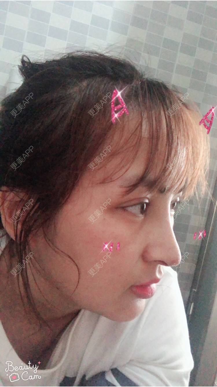 更美 - 淡淡蛋蛋的下巴经验 | 下巴 | 南宁