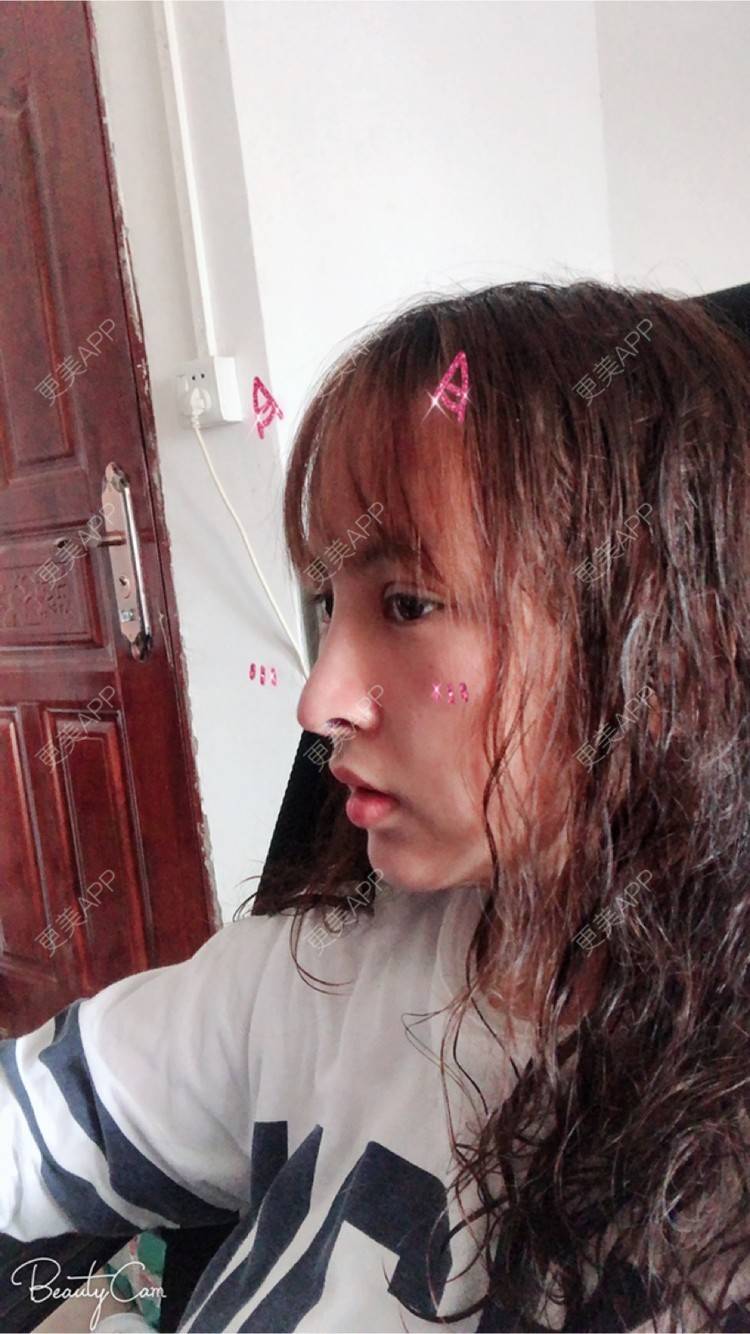 更美 - 淡淡蛋蛋的下巴经验 | 下巴 | 南宁