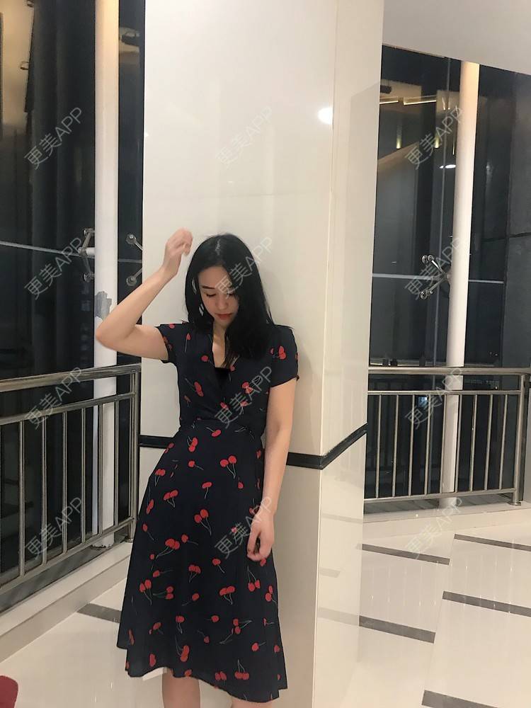 更美 - 葡萄啊香蕉的微针淡化妊娠纹经验 | 郑州 | 微针淡化妊娠纹