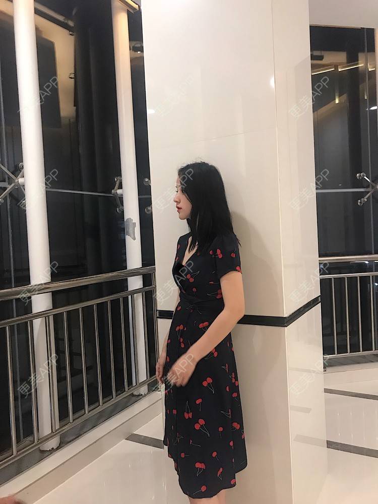 更美 - 葡萄啊香蕉的微针淡化妊娠纹经验 | 郑州 | 微针淡化妊娠纹