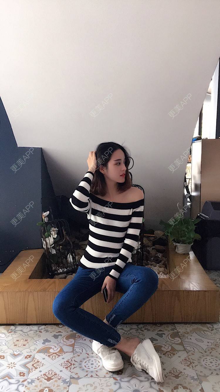 更美 - 葡萄啊香蕉的微针淡化妊娠纹经验 | 郑州 | 微针淡化妊娠纹