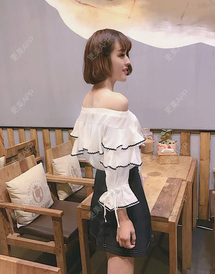 更美 - 葡萄啊香蕉的微针淡化妊娠纹经验 | 郑州 | 微针淡化妊娠纹