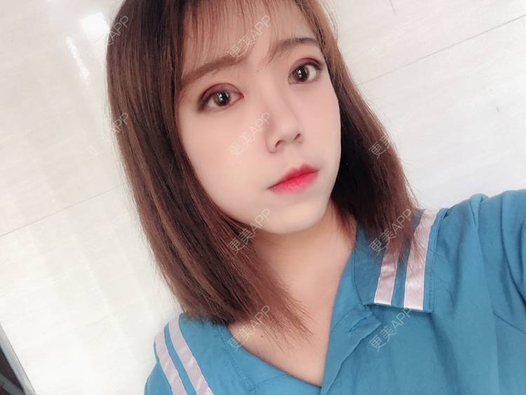 更美 - 武汉韩辰医疗美容医院的全切双眼皮经验 | 全切双眼皮
