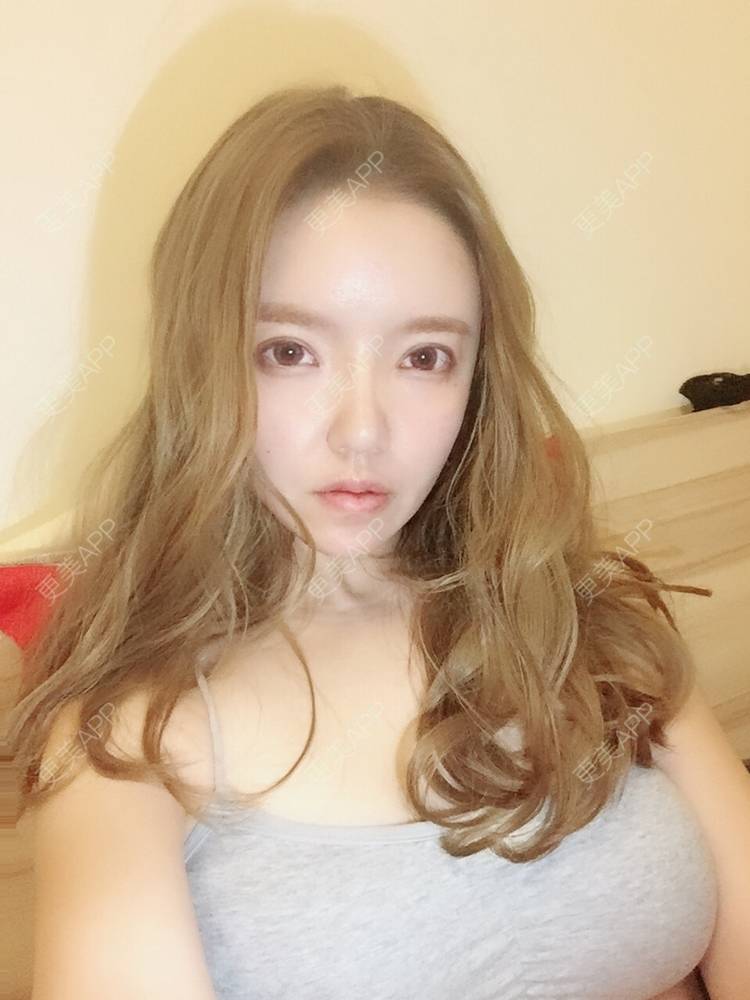 大芒果宝宝的假体隆胸日记