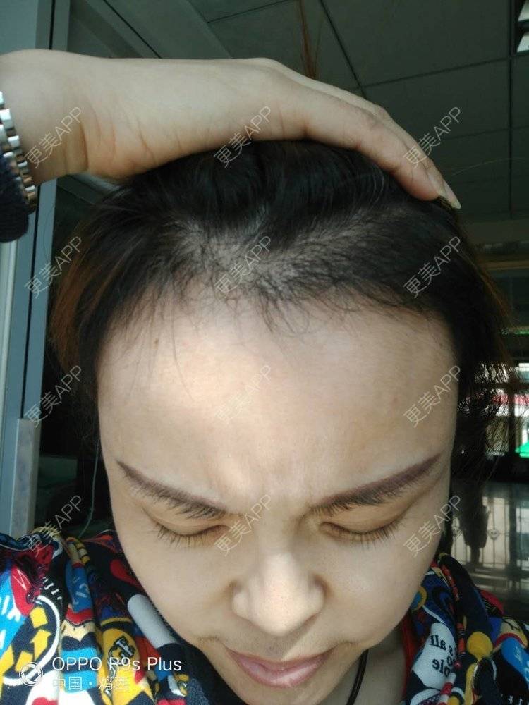更美 - 刘爽 医生的经验 | 哈尔滨