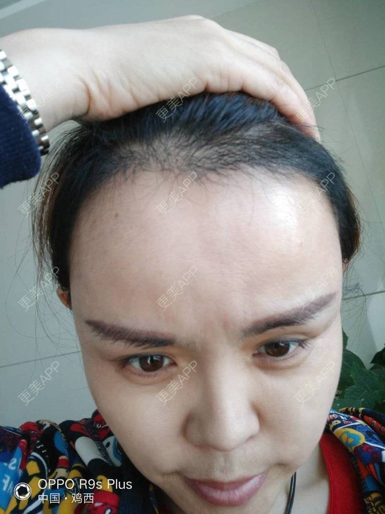 更美 - 刘爽 医生的经验 | 哈尔滨