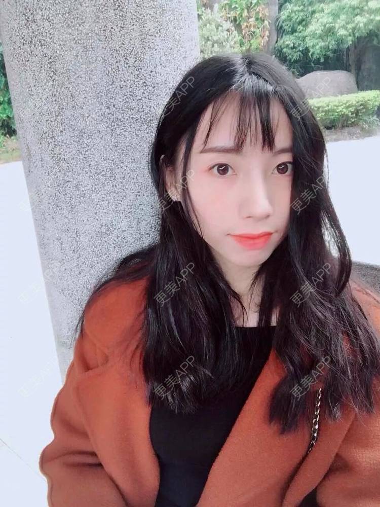 更美 - 范倩茜 医生的隆鼻经验 | 隆鼻 | 西安