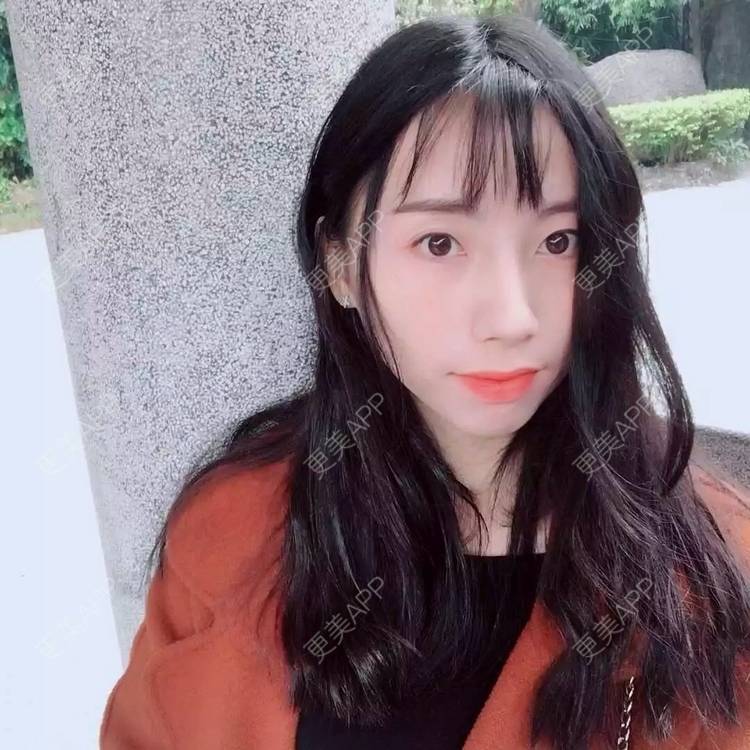 更美 - 范倩茜 医生的隆鼻经验 | 隆鼻 | 西安