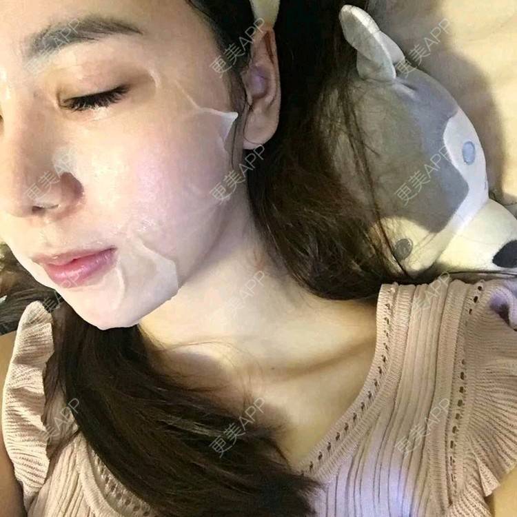 更美 - 小小固执的全切双眼皮经验 | 视频日记 | 全切双眼皮 | 广州