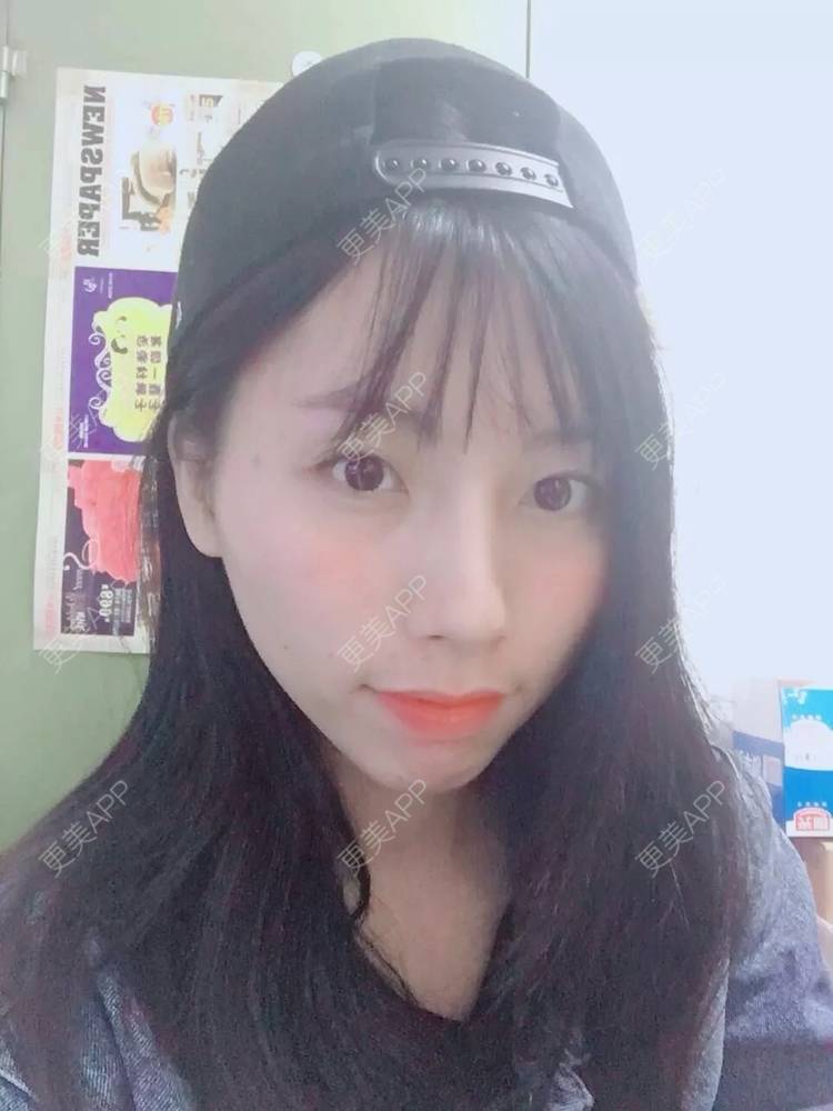 更美 - 范倩茜 医生的水光项目经验 | 水光项目 | 西安