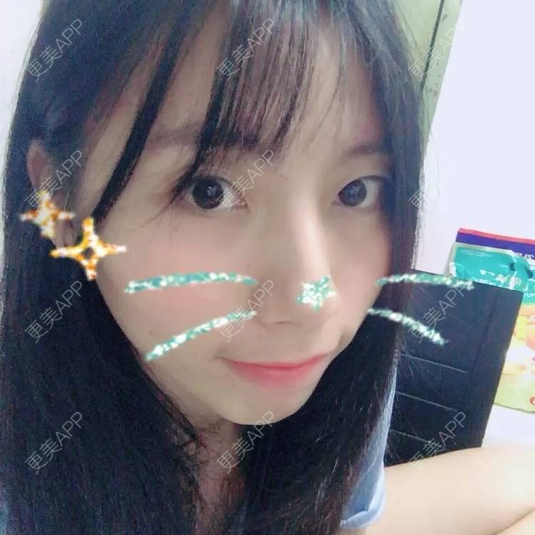 更美 - 范倩茜 医生的除皱瘦脸经验 | 除皱瘦脸 | 西安