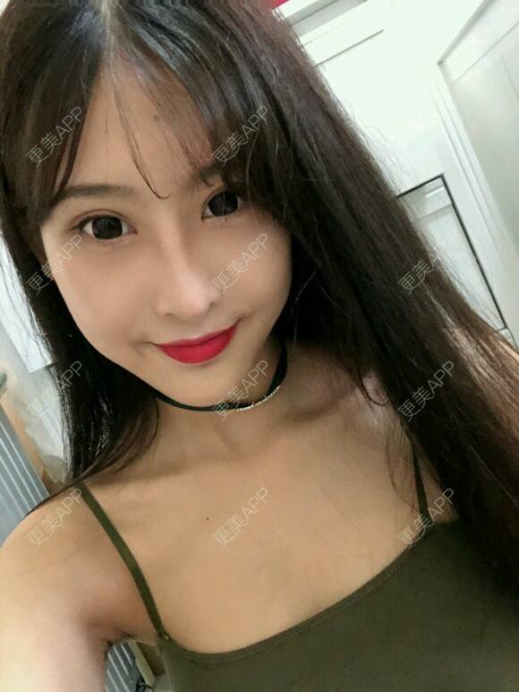 更美 - 酷帅北鼻妞儿的胶原蛋白丰太阳穴经验 | 北京 | 胶原蛋白丰太阳穴