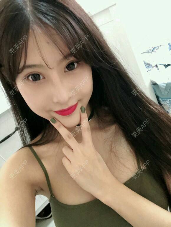 更美 - 酷帅北鼻妞儿的胶原蛋白丰太阳穴经验 | 北京 | 胶原蛋白丰太阳穴