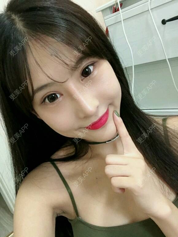 更美 - 酷帅北鼻妞儿的胶原蛋白丰太阳穴经验 | 北京 | 胶原蛋白丰太阳穴